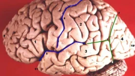 tdah-adultos-cerebro-wide_webp